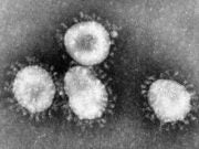 Coronavirus cells